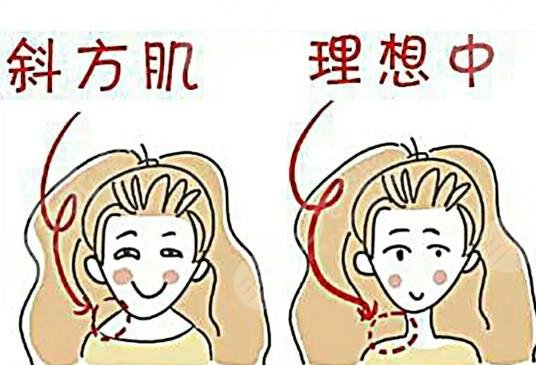 適應的人群都有哪些呢?