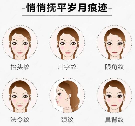 成都注射瘦臉打幾次能定型 輕松趕走大餅臉