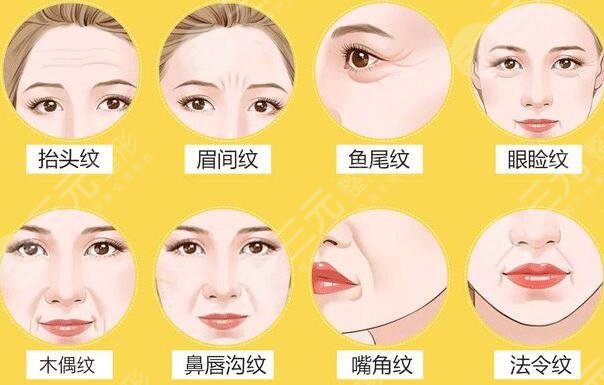 【超全】注射rd素避雷指南！降低風險變美看這篇就夠了！