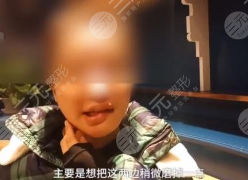 女子整容失敗嘴歪眼斜