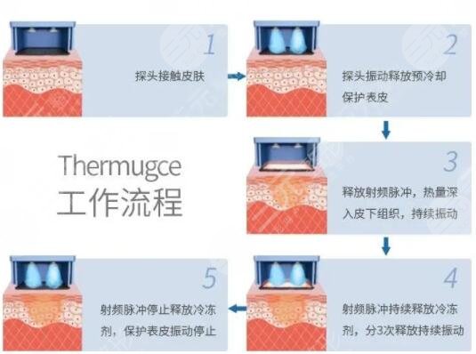 賽諾秀5D果可以維持多久？