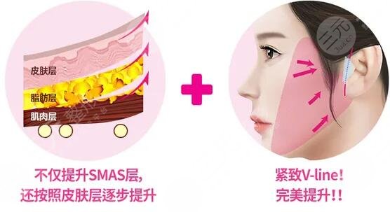 賽諾秀5D項目術(shù)后注意