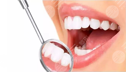 烤瓷牙套和全瓷牙套哪個(gè)好一點(diǎn)？