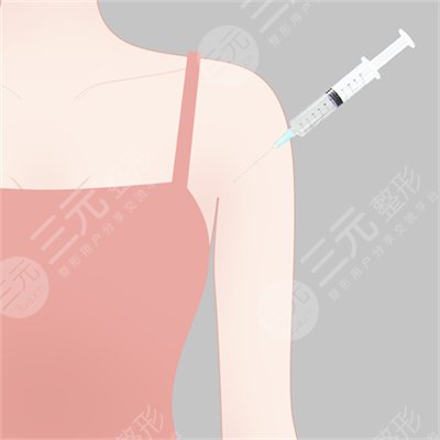 蝴蝶袖怎么減？蝴蝶袖怎么減速度Z快？