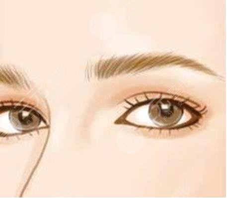 紋眼線,多久,恢復(fù)