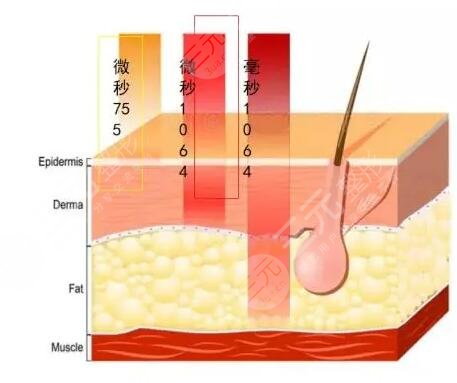 賽諾秀5d膠原光的術(shù)后注意事項：