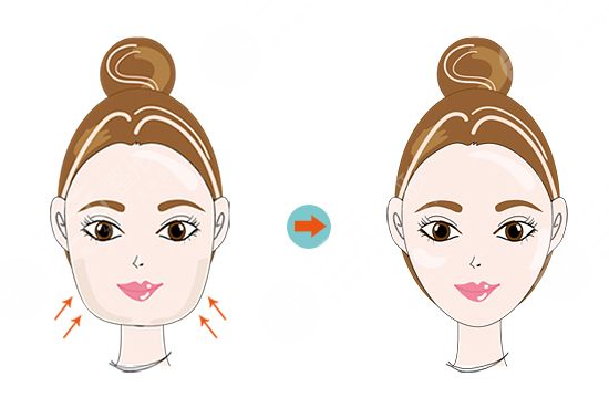 面部光纖溶脂的副作用有哪些?