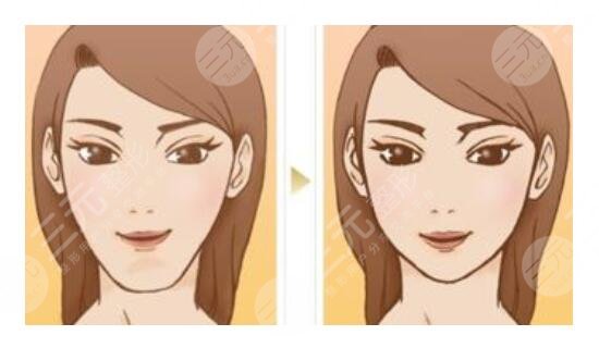 太陽(yáng)穴凹陷