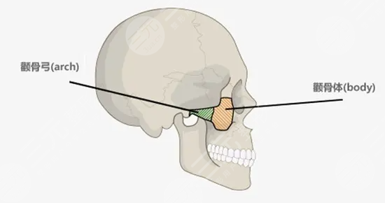 顴弓降低下垂的原因