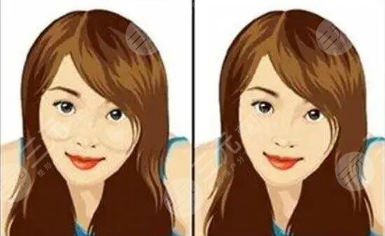 微整形果如何？ 得看你術(shù)后保養(yǎng)！