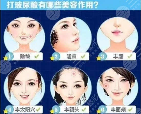 潤百顏白紫玻尿酸果怎么樣，多少錢一支？分享優(yōu)點(diǎn)&價(jià)格，注意事項(xiàng)！