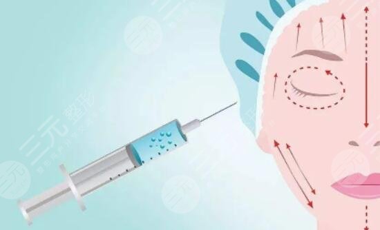 注射玻尿酸有副作用嗎 玻尿酸注射有什么副作用