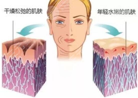 水光補(bǔ)水可以解決毛孔粗大嗎