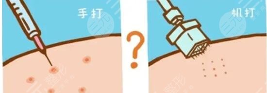 打水光補水,過程,有沒有,副作用