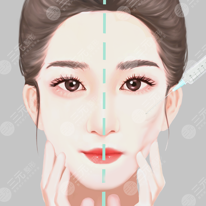 鼻唇溝整形方法科普！怎么消除，用什么填充？科普助美我教你！