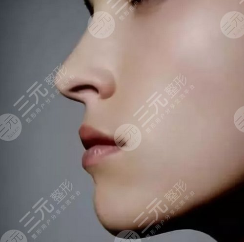 鼻翼缺損手術(shù)以后的注意事項(xiàng)