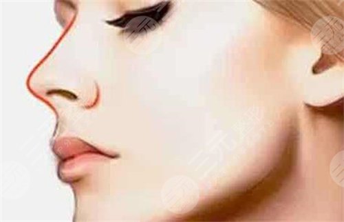 鼻翼缺損矯正手術(shù)會(huì)留疤嗎?