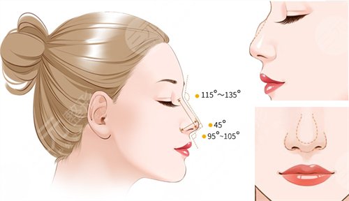 做歪鼻矯正手術(shù)的果，讓你的鼻子“改邪歸正”