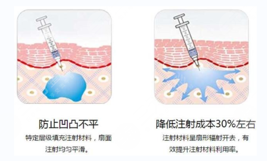 玻尿酸與明星們 玻尿酸與明星們