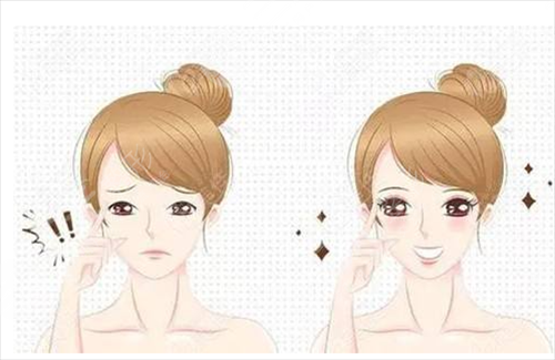 上瞼下垂術(shù)后注意事項(xiàng)