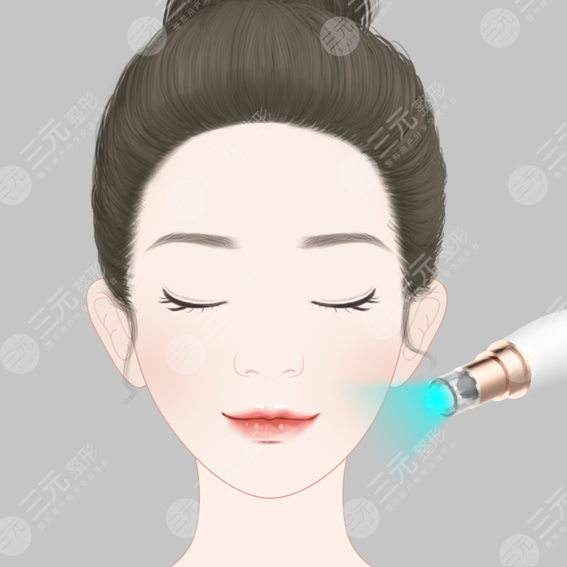 注射水光補(bǔ)水好不好 注射水光補(bǔ)水需要幾次療程