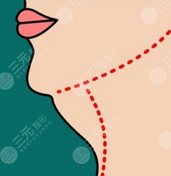 怎么減去雙下巴 怎么減去雙下巴