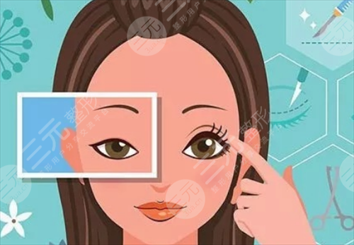 歐式芭比網(wǎng)紅眼睛太過(guò)夸張