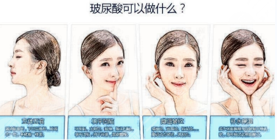 注射瘦臉|玻尿酸注射去皺哪種方法好？有什么區(qū)別？