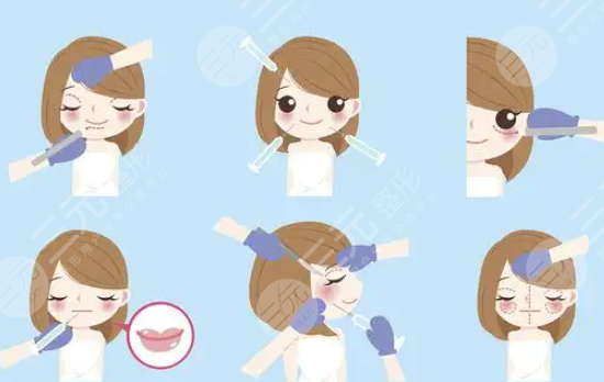 面部注射能讓你美出幾分？日本微整形的藝術(shù)性