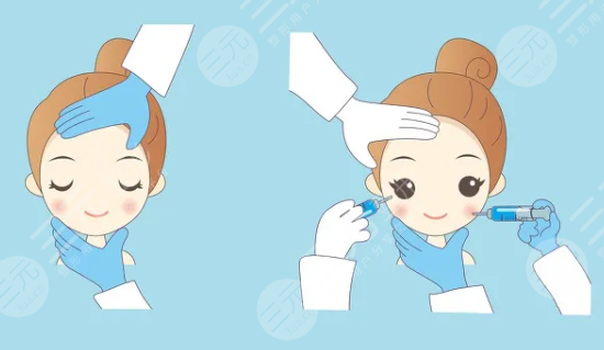 注射美容能維持多久？多久可以看到果？