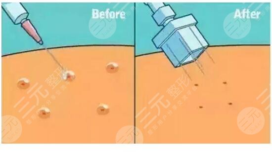 打水光補(bǔ)水后注意事項(xiàng)有哪些呢?