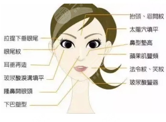 玻尿酸注射除皺果怎么樣?玻尿酸注射除皺果好不好?