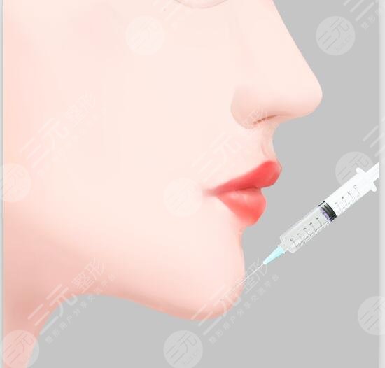 玻尿酸下巴打完什么果