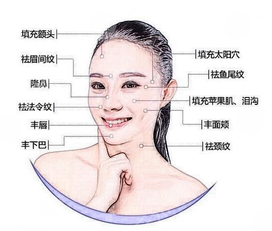 玻尿酸豐面頰費(fèi)用多少