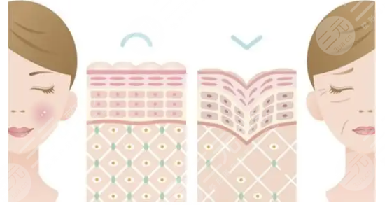 膠原蛋白面部填充怎么樣