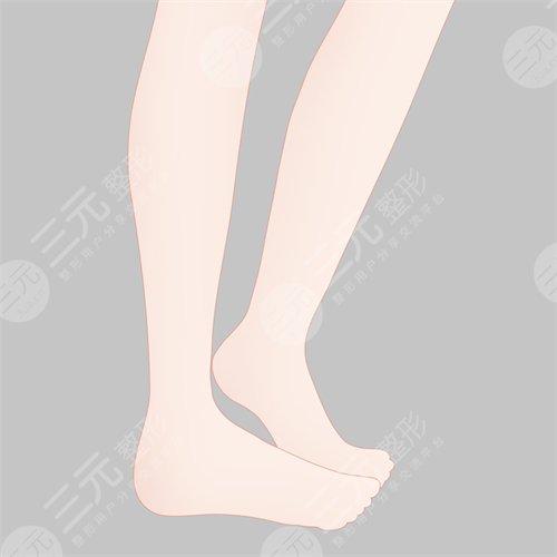 小腿吸脂術(shù)后多久恢復(fù)正常 小腿吸脂術(shù)后多久恢復(fù)正常