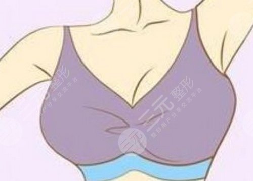乳房下垂矯正手術(shù)后會再松弛嗎