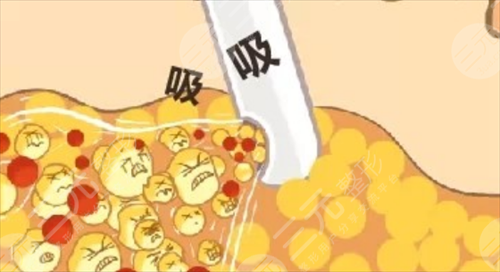 4d火鳳凰溶脂果怎么樣？可靠性如何？多久出果？