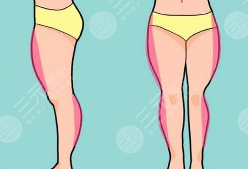 如何瘦小腿？3種方法