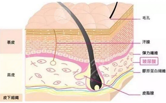 打玻尿酸多少錢一針？為什么價格會有差異？