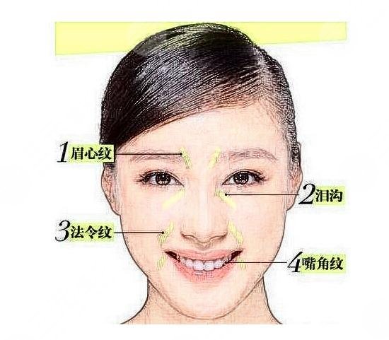 法令紋填充用什么品牌的玻尿酸好？這些還不錯(cuò)~