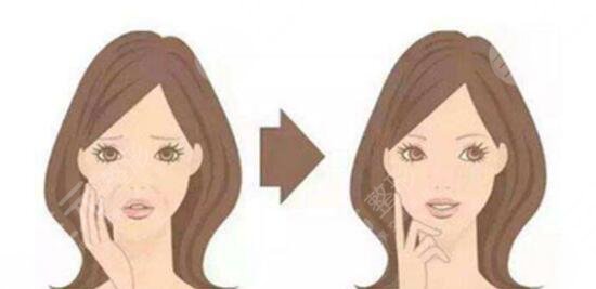 怎樣快速去除魚尾紋？3種方法有抹去眼角痕跡！
