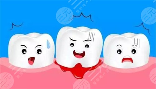 隱適美和傳統(tǒng)牙套優(yōu)劣比較