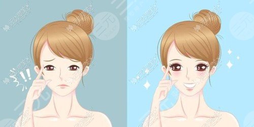 <b>射頻美容的副作用</b>