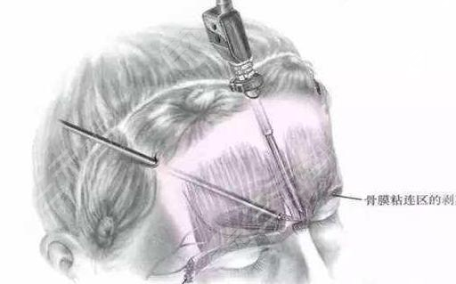 微l美是什么 果怎么樣