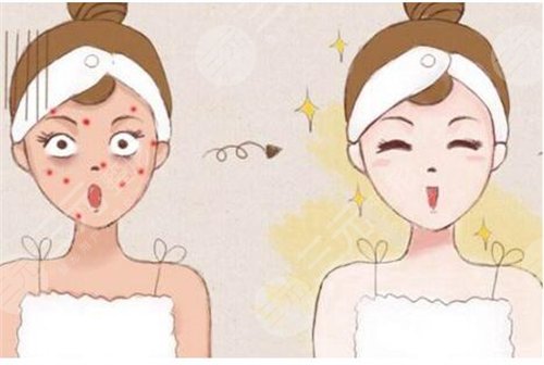 年度皮膚醫(yī)美報告：看我是如何擺脫問題肌膚的~