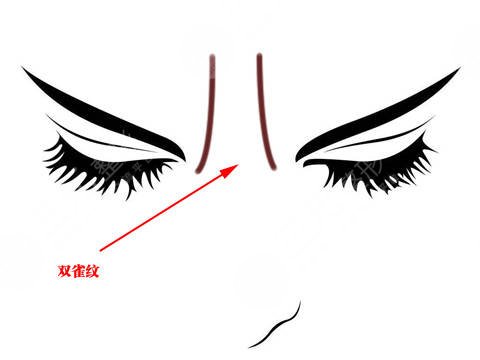 射頻去川字紋會疼嗎