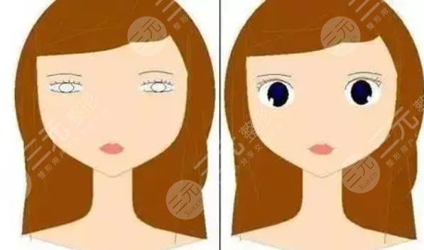 女子割雙眼皮!當(dāng)場喪命