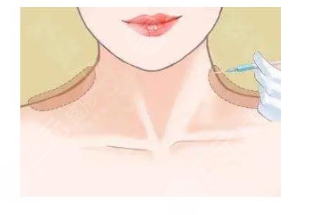 打三次能保持多久果?可以做按摩嗎?