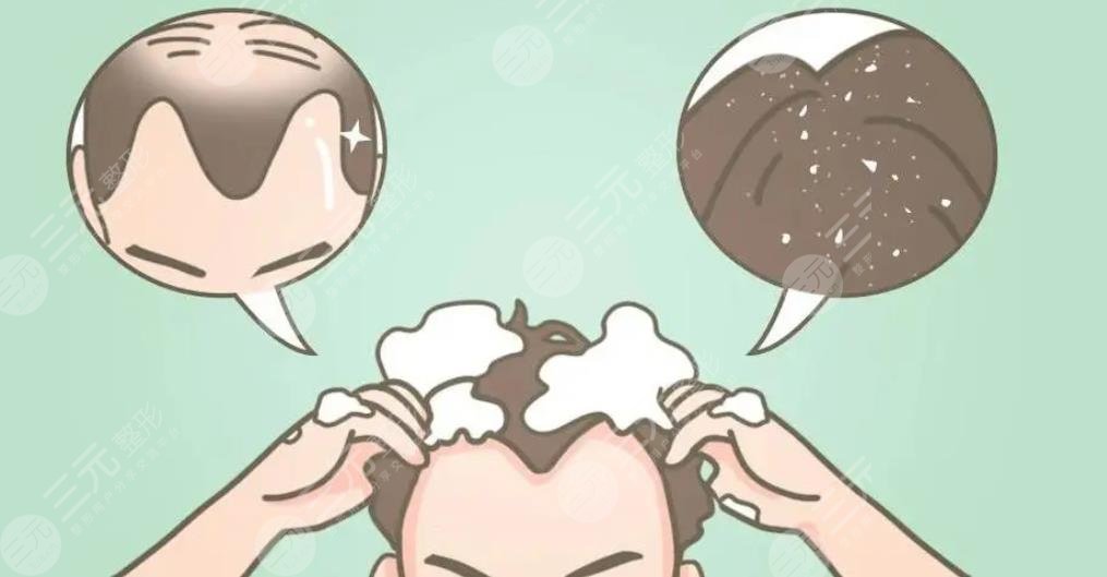 頭皮屑多頭皮癢掉頭發(fā)該怎么治?